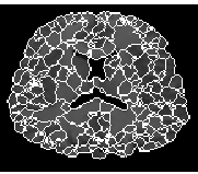 \epsfig{figure=../figures_98/aymeric_imLpeGrad.ps,width=4cm}