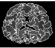 \epsfig{figure=../figures_98/aymeric_imLpe400.ps,width=4cm}