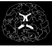 \epsfig{figure=../figures_98/aymeric_imVentr.ps,width=4cm}