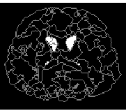\epsfig{figure=../figures_98/aymeric_imCaud.ps,width=4cm}